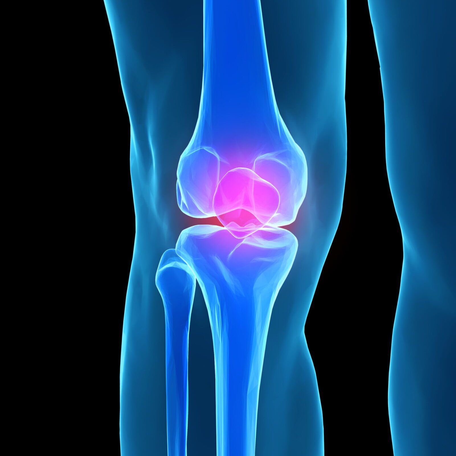 Human knee anatomy with femur, tibia and fibula bones under X-rays isolated on black.